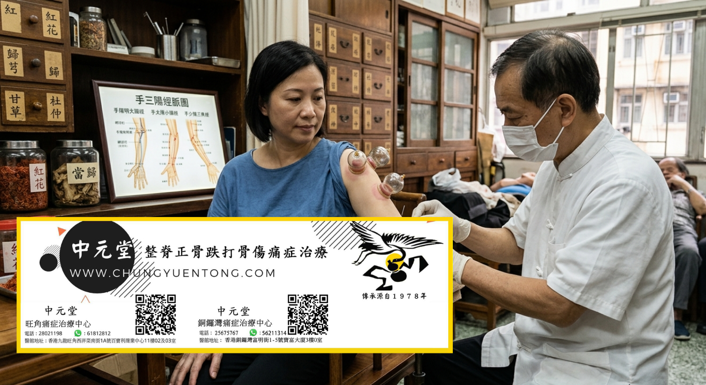 中元堂拔罐 - 上臂拔罐配合針灸調理 上臂拔罐配合針灸 - 中元堂註冊中醫師親診上肢痠痛網球肘 - 香港中醫拔罐針灸綜合調理