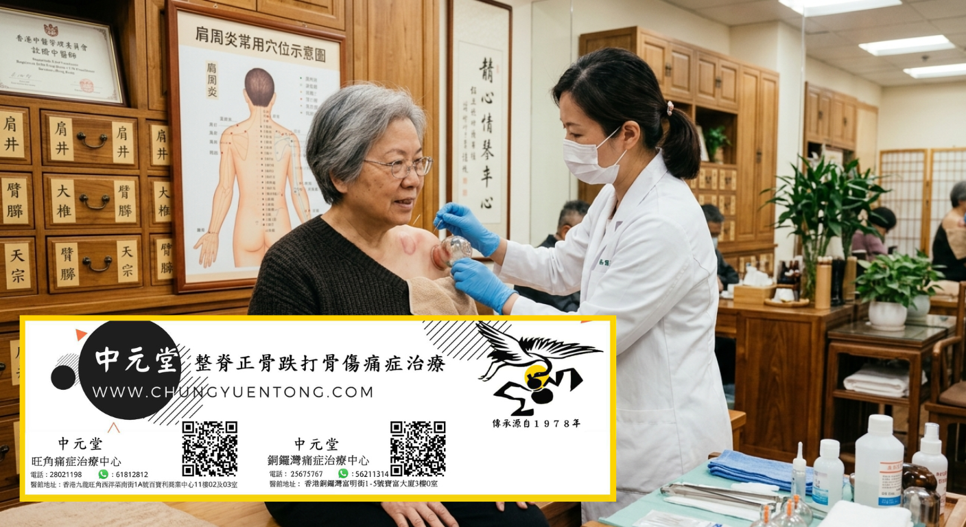 中元堂拔罐 - 肩部拔罐對症肩周炎 肩部拔罐治療肩周炎 - 中元堂註冊中醫師依肩周炎穴位示意圖 - 香港中醫拔罐祛濕